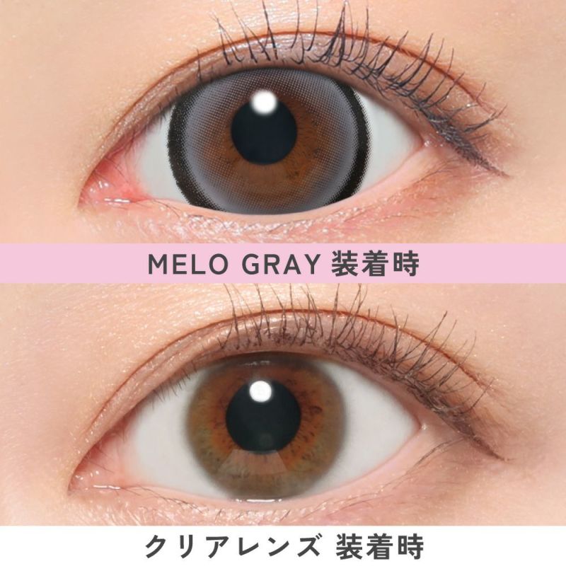 メログレー比較画像